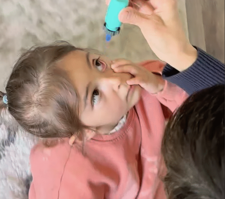 Parent gently applying eye drops to a young child using the Nanodropper adaptor."